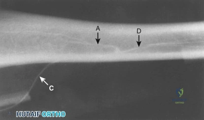 Clinical Image