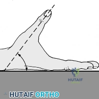 Clinical Image
