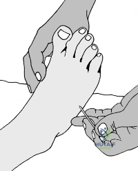 Clinical Image