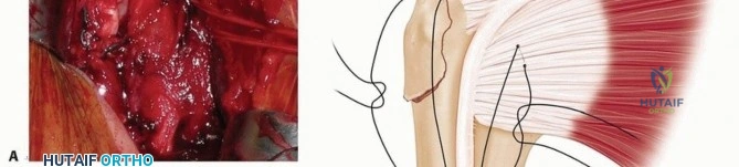 Clinical Image