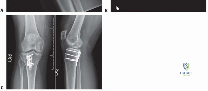 Clinical Image
