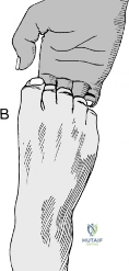 Clinical Image
