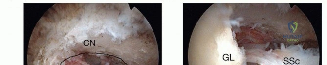 Clinical Image