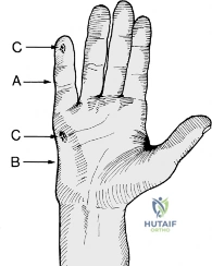 Clinical Image