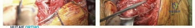 Clinical Image
