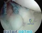 Clinical Image