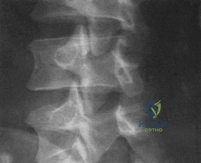 Clinical Image