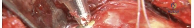 Clinical Image