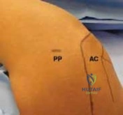 Clinical Image