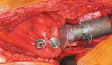 Clinical Image