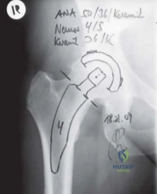 Clinical Image