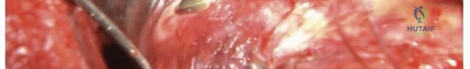Clinical Image