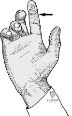 Clinical Image