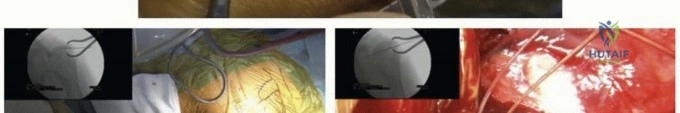 Clinical Image