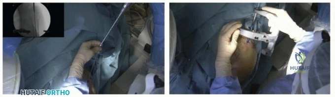 Clinical Image