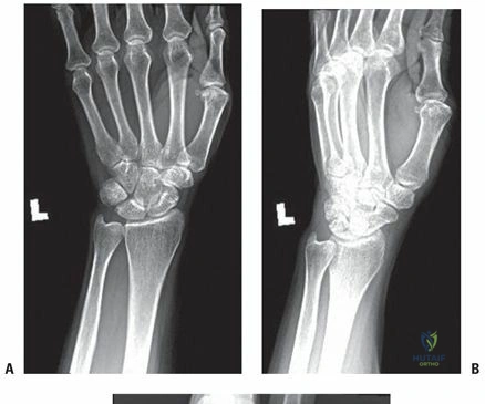 Clinical Image