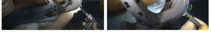 Clinical Image