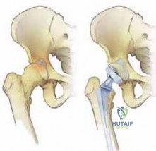 Clinical Image