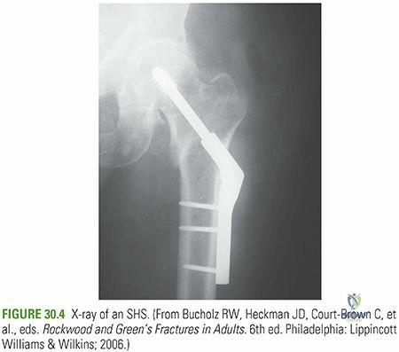 Clinical Image