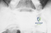 Clinical Image