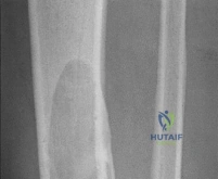 Clinical Image