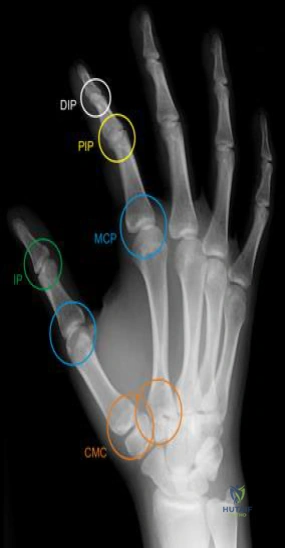 Clinical Image