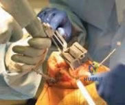 Clinical Image