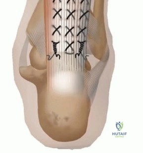 Clinical Image