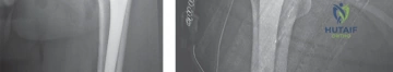 Clinical Image