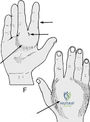 Clinical Image