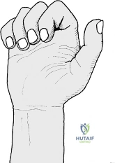 Clinical Image