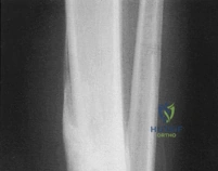 Clinical Image
