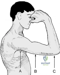 Clinical Image