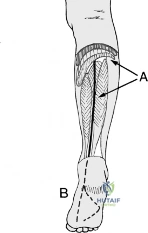 Clinical Image