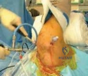 Clinical Image