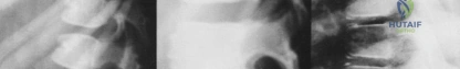 Clinical Image