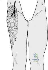 Clinical Image
