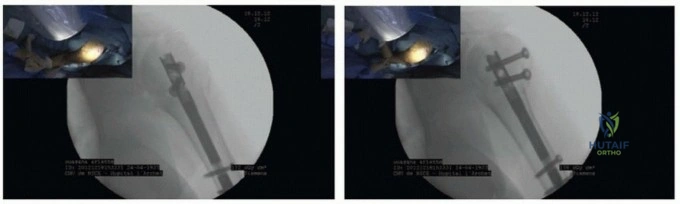 Clinical Image