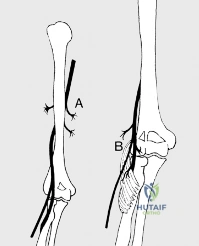 Clinical Image