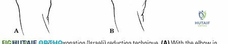 Clinical Image