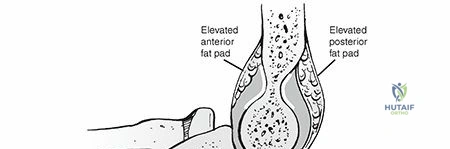 Clinical Image