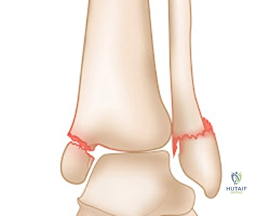 Clinical Image