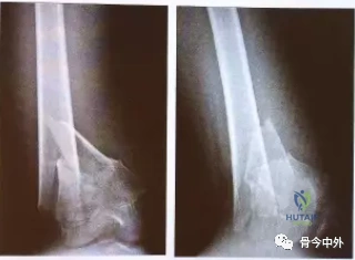 Clinical Image