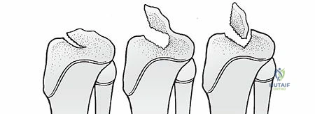 Clinical Image
