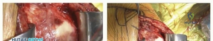 Clinical Image
