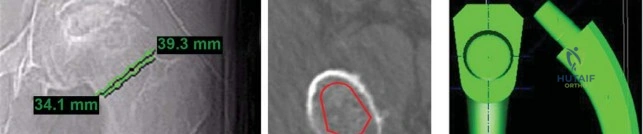 Clinical Image
