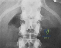 Clinical Image