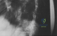 Clinical Image