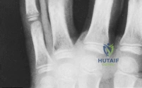 Clinical Image