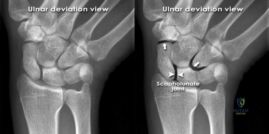 Clinical Image